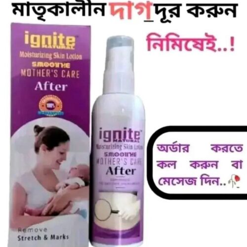 Ignite Mother Care Lotion(After)