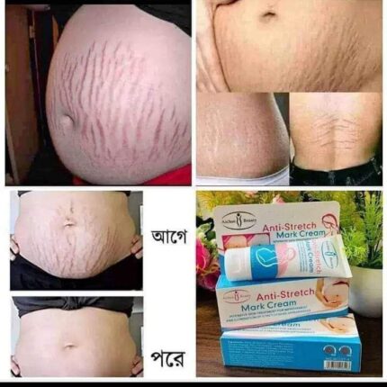 Anti Stretch mark cream