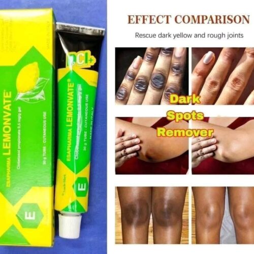 Esapharma Lemonvate Clobetasol Propionate Gel (30g)